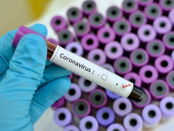 Шесть подтвержденных случаев коронавируса зафиксировали в России