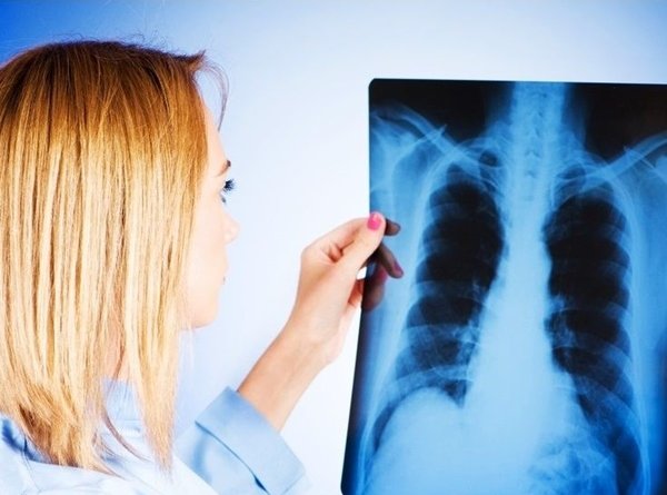 Новый рентгеновский аппарат появится в Волгодонске