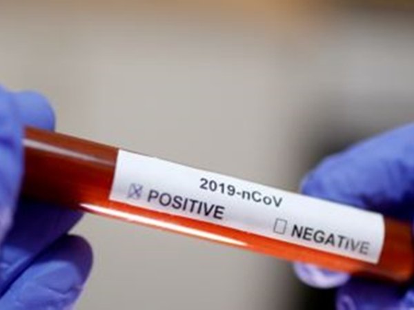 На территории России за сутки выявили 61 новый случай заражения COVID-19
