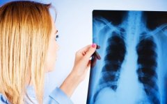 Новый рентгеновский аппарат появится в Волгодонске