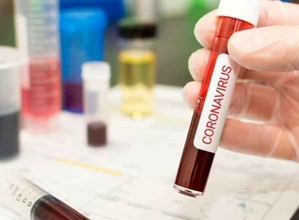В Ростовской области зарегистрировано 9 новых больных COVID-19