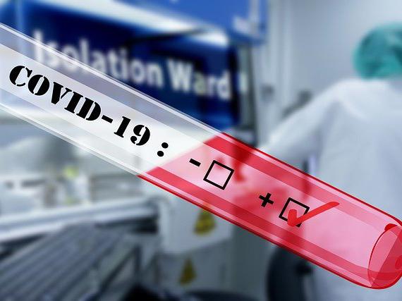На Дону выявлено еще 115 новых зараженных COVID-19: трое скончались