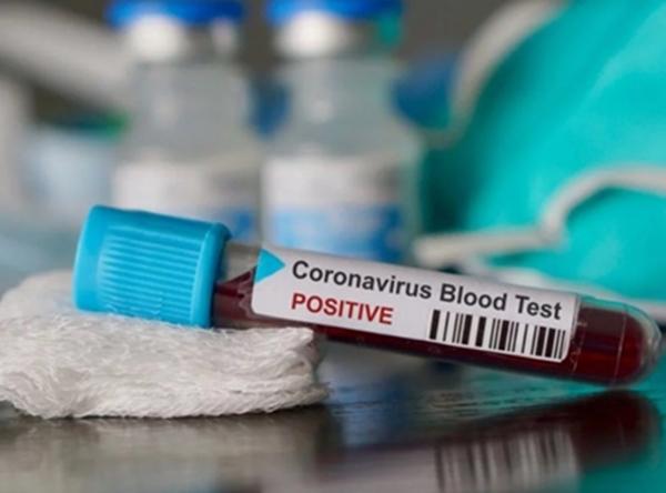 У 80 жителей Волгодонска подтвержден COVID-19