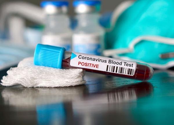 COVID-19 подтвержден еще у двух жителей Волгодонска