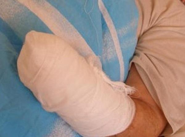 Житель села Дубовское с отрубленными кистью и пальцами ног изменил свои показания