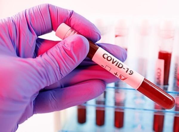 Количество заболевших COVID-19 в России увеличилось на 8 135 человек