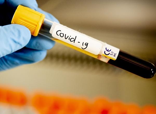 У 1 293 жителей Волгодонска обнаружен COVID-19