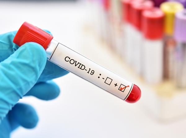 Коронавирус обнаружен еще у 21 жителя Волгодонска