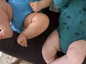 В Волгодонске зарегистрировали редкую «королевскую» двойню