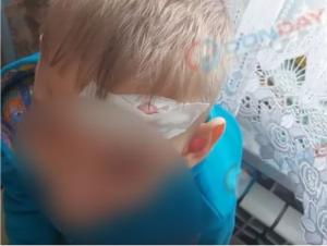 Ребенка с пробитой головой пришлось везти из Цимлянска в Волгодонск из-за отсутствия хирурга