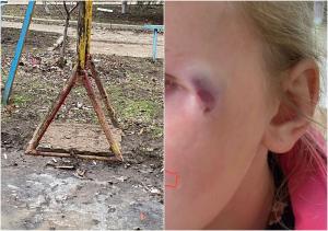 «Ежегодно скорая увозит детей с травмами»: жители Волгодонска пожаловались на опасную детскую площадку